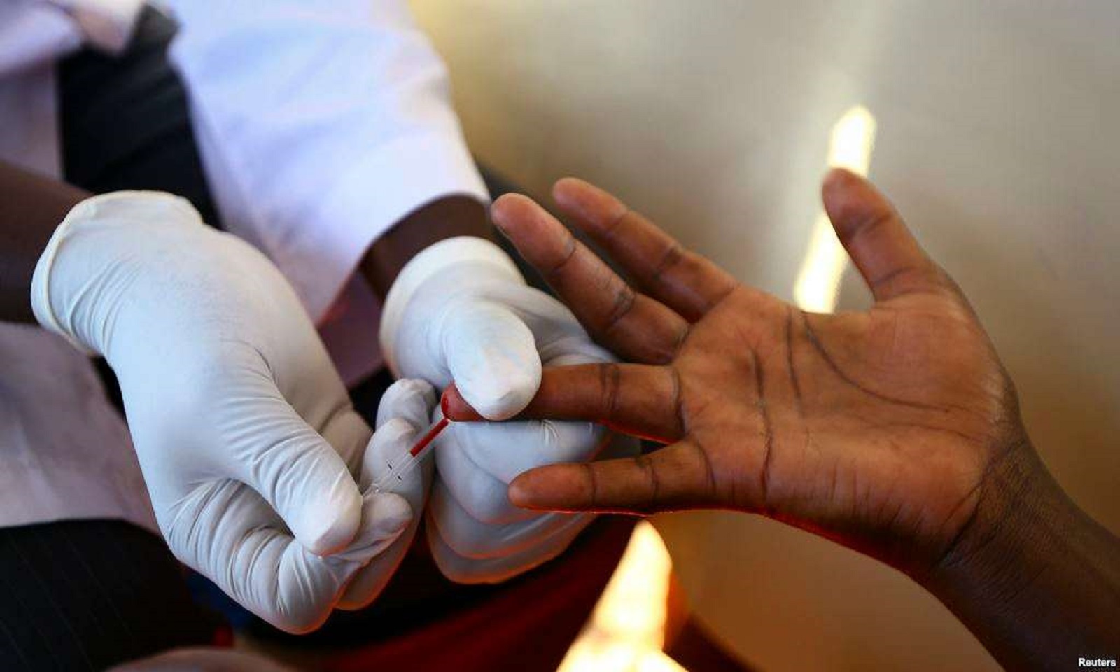 HIV Testing
